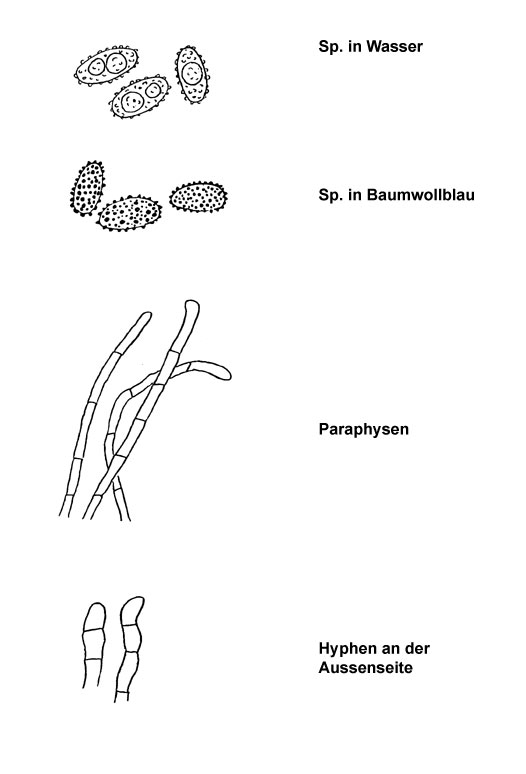 Peziza depressa, brunneoatra, (celtica)
